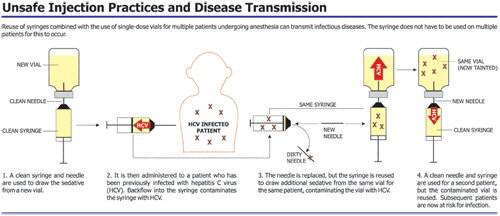 Hepatitis C Investigation Graphic on How Patients were exposed